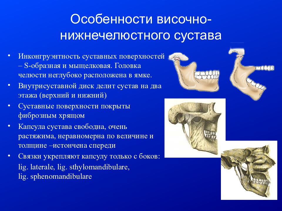 Внчс это. Внутрисуставной диск ВНЧС. Мыщелковый сустав нижней челюсти. Инконгруэнтность сустава височно нижнечелюстного. Нижнечелюстной сустав анатомия классификация.