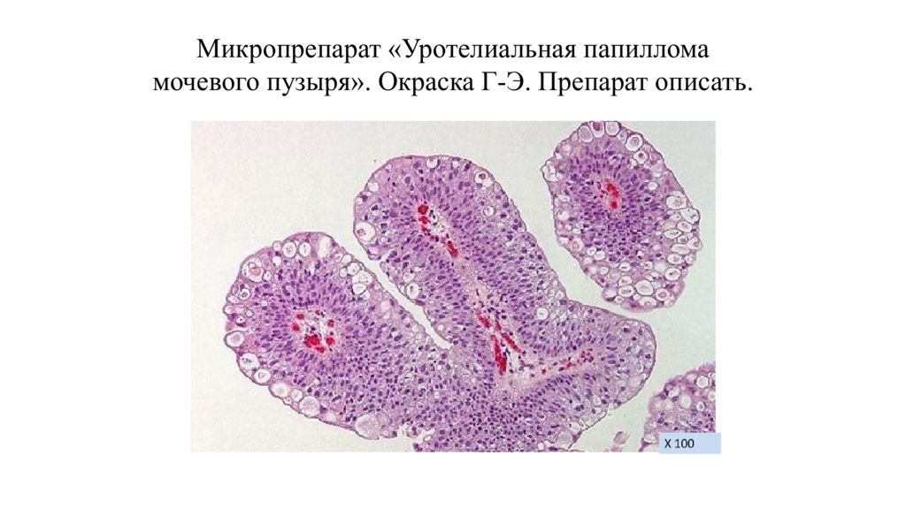 Микропрепарат папиллома кожи рисунок