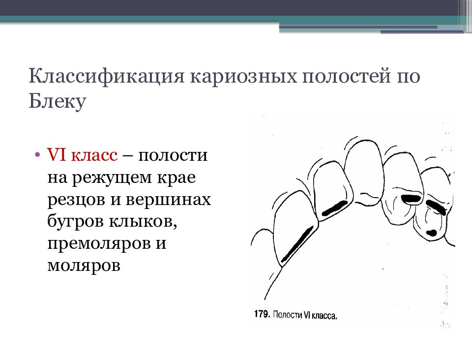 Классификация полостей