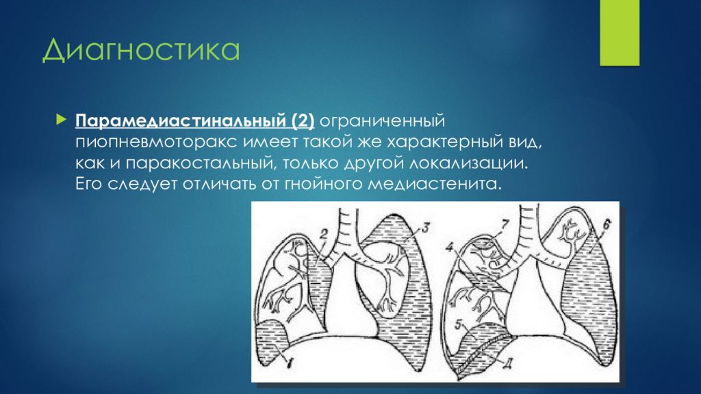 6 полость. Паракостальный плеврит. Парамедиастинальный плеврит. Парамедиастинальные отделы легких.