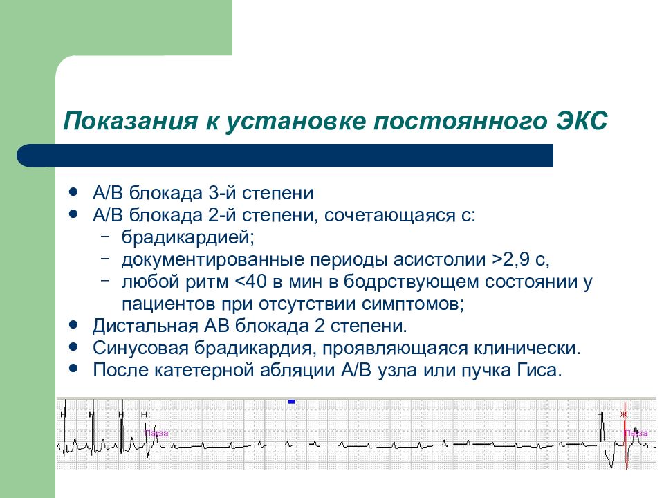 Назначение экс. Показания к постоянной кардиостимуляции. Показания к постоянной экс. Показания к имплантации искусственного водителя ритма. Показания к имплантации экс.