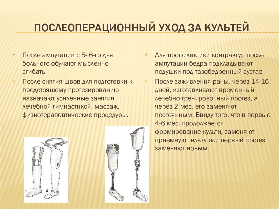 Костно пластическая ампутация бедра по гритти шимановскому. Гритти Шимановскому Альбрехту костно-пластическая ампутация. Костно пластическая ампутация бедра по Гритти. Костно пластическая ампутация голени по Гритти Шимановскому. Костно-пластическая ампутация бедра по Гритти-Шимановскому-Альбрехт.